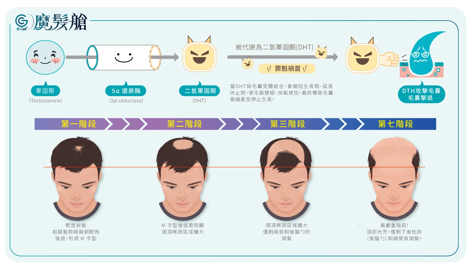 1 1 最新消息 落髮步驟