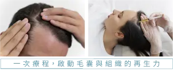2 啟動再生 2 補字