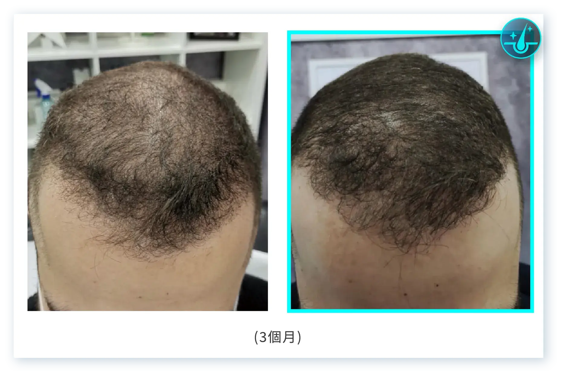 3個月@3x